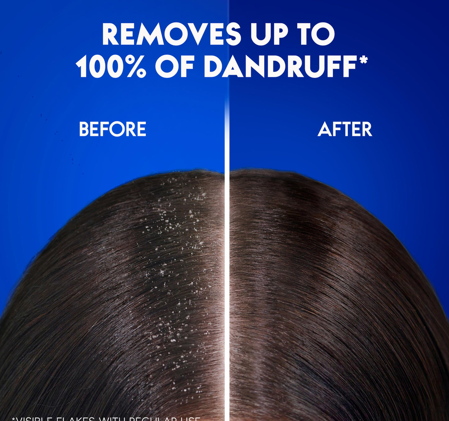 Head & Shoulders Apple Fresh Anti-Dandruff Shampoo 400 ml